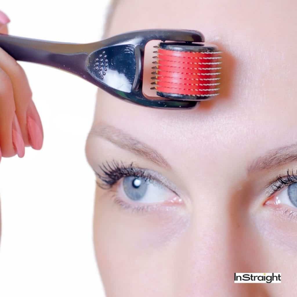 dermarolling on lady's forehead